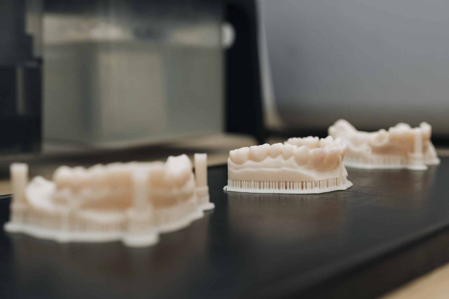 3D-Drucke eines Gebisses für die Herstellung von Veneers